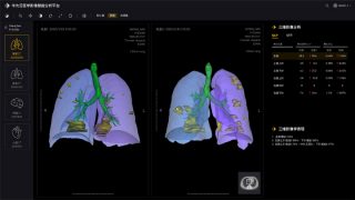 Huawei Cloud launches AI-assisted diagnosis for COVID-19