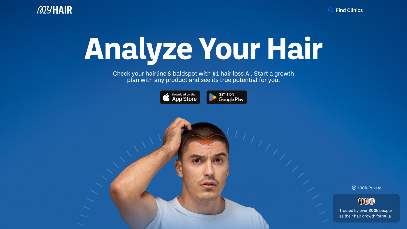 AI app analyzing scalp hair density for early balding detection